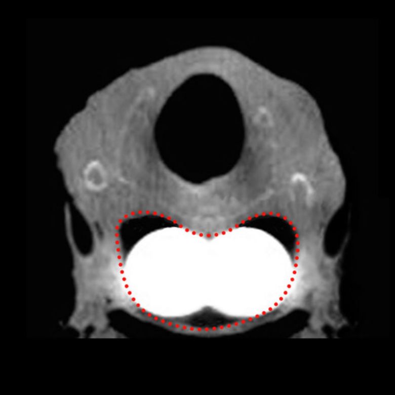 Infinity vs. Conventional Devices